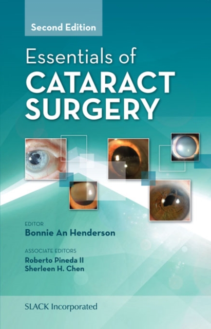 Essentials of Cataract Surgery, Second Edition, PDF eBook