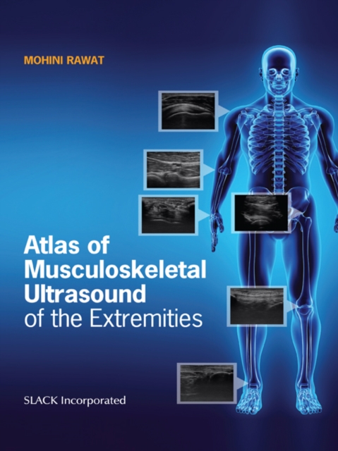 Atlas of Musculoskeletal Ultrasound of the Extremities, EPUB eBook