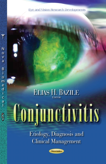 Conjunctivitis : Etiology, Diagnosis and Clinical Management, PDF eBook