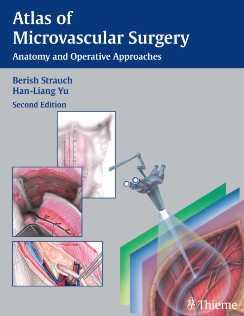 Atlas of Microvascular Surgery : Anatomy and Operative Techniques, EPUB eBook