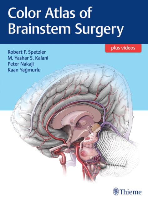Color Atlas of Brainstem Surgery, EPUB eBook