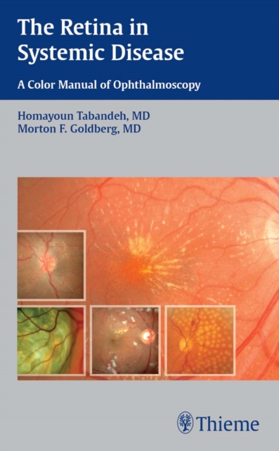 The Retina in Systemic Disease : A Color Manual of Ophthalmoscopy, EPUB eBook