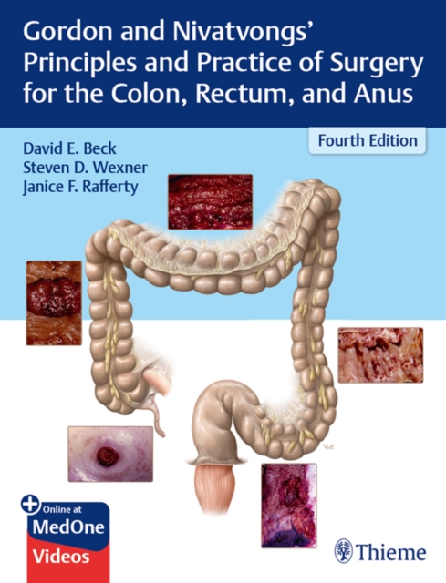 Gordon and Nivatvongs' Principles and Practice of Surgery for the Colon, Rectum, and Anus, EPUB eBook