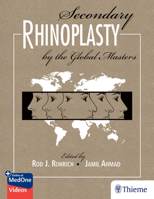 Secondary Rhinoplasty by the Global Masters, EPUB eBook