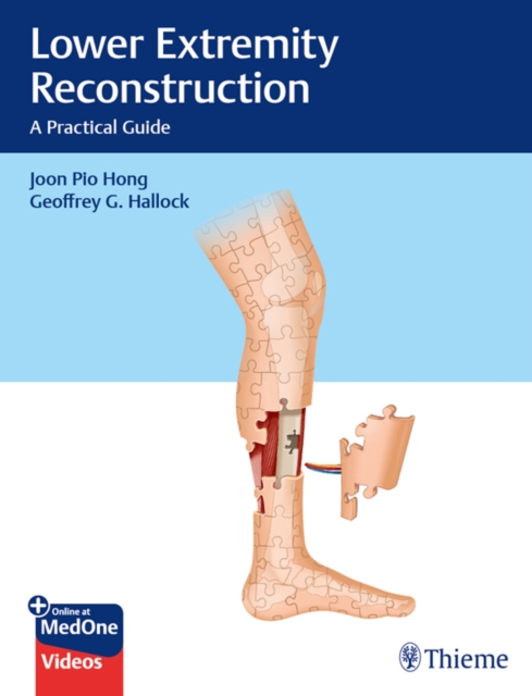 Lower Extremity Reconstruction : A Practical Guide, EPUB eBook