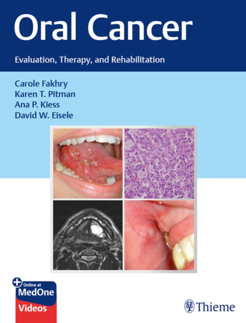 Oral Cancer : Evaluation, Therapy, and Rehabilitation, EPUB eBook
