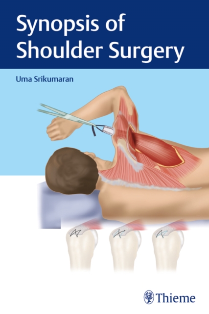 Synopsis of Shoulder Surgery, EPUB eBook
