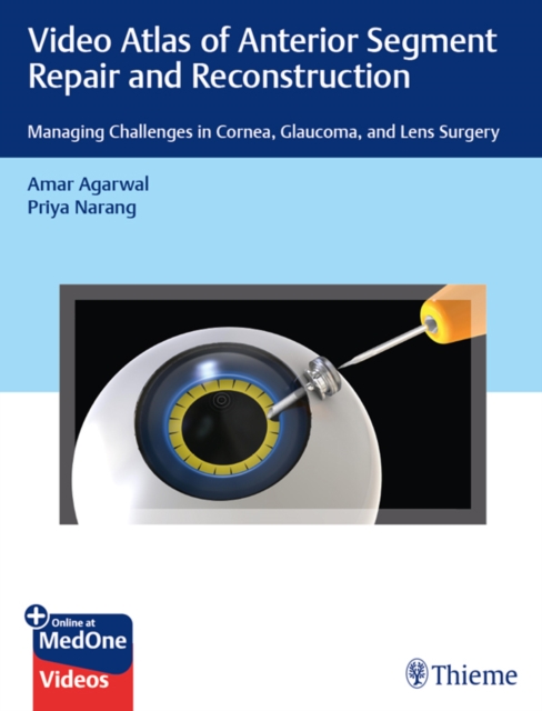 Video Atlas of Anterior Segment Repair and Reconstruction : Managing Challenges in Cornea, Glaucoma, and Lens Surgery, EPUB eBook