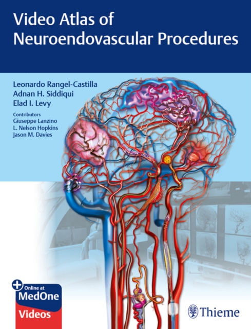 Video Atlas of Neuroendovascular Procedures, EPUB eBook