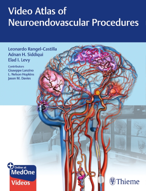 Video Atlas of Neuroendovascular Procedures, EPUB eBook