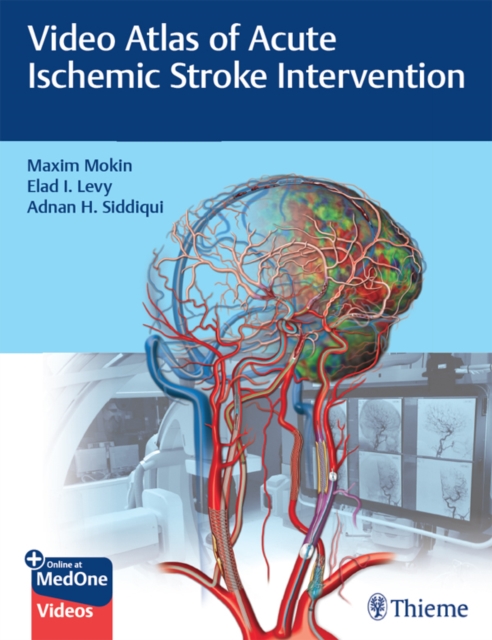 Video Atlas of Acute Ischemic Stroke Intervention, EPUB eBook