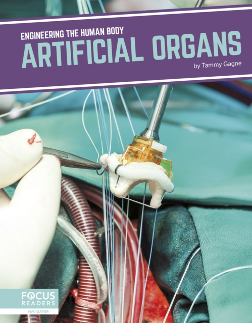 Engineering the Human Body: Artificial Organs, Hardback Book