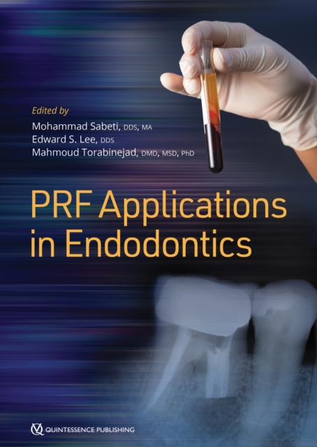 PRF Applications in Endodontics, EPUB eBook