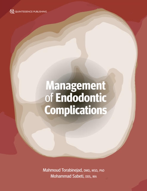 Management of Endodontic Complications : From Diagnosis to Prognosis, PDF eBook