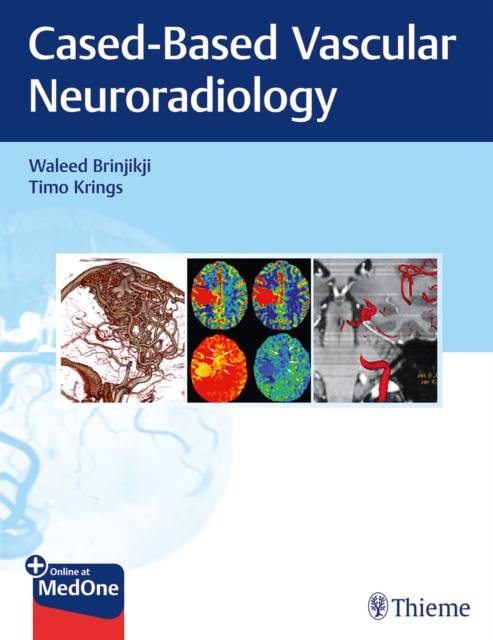 Imaging in Neurovascular Disease : A Case-Based Approach, Mixed media product Book