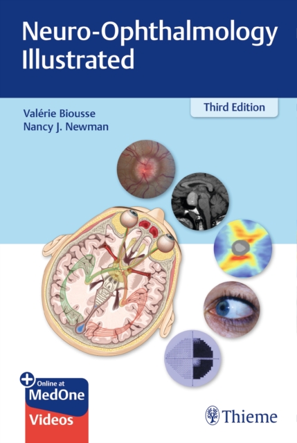 Neuro-Ophthalmology Illustrated, Multiple-component retail product, part(s) enclose Book