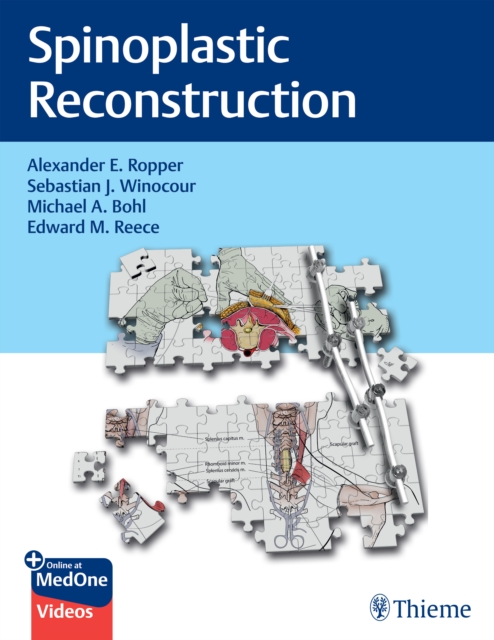 Spinoplastic Reconstruction, EPUB eBook