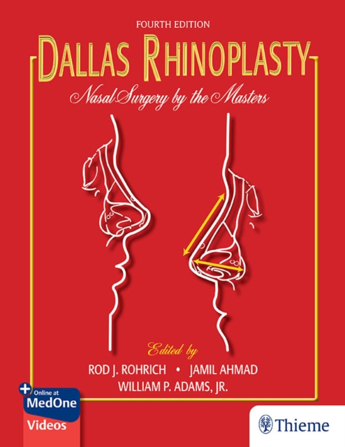 Dallas Rhinoplasty : Nasal Surgery by the Masters, EPUB eBook