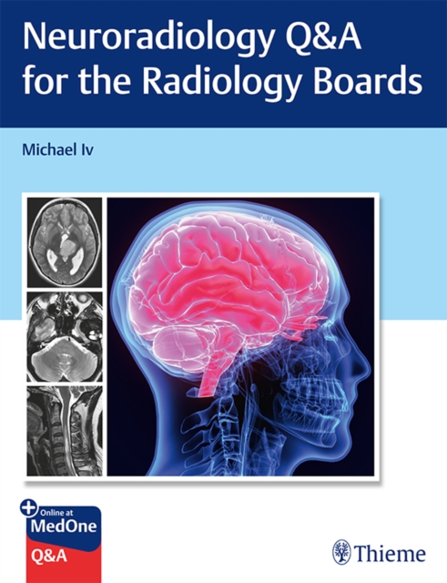 Neuroradiology Q&A for the Radiology Boards, EPUB eBook