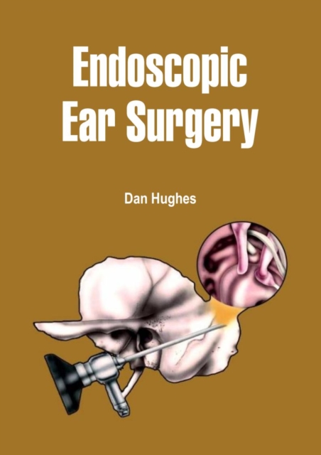 Endoscopic Ear Surgery, EPUB eBook