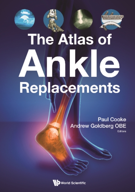 Atlas Of Ankle Replacements, The, EPUB eBook