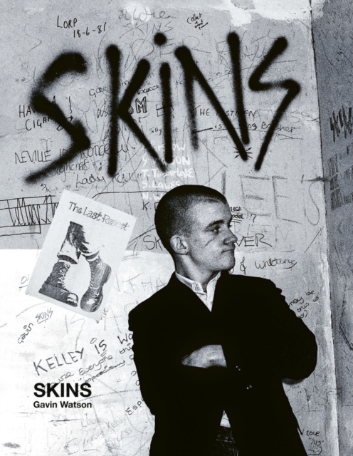 Skins : Gavin Watson, Hardback Book