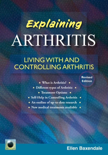 An Emerald Guide To Explaining Arthritis : Living with and Controlling Arthritis, Paperback / softback Book