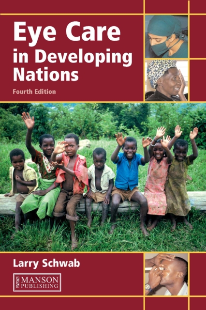 Eye Care in Developing Nations, PDF eBook