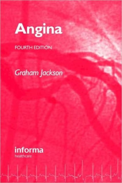 Angina, Paperback / softback Book
