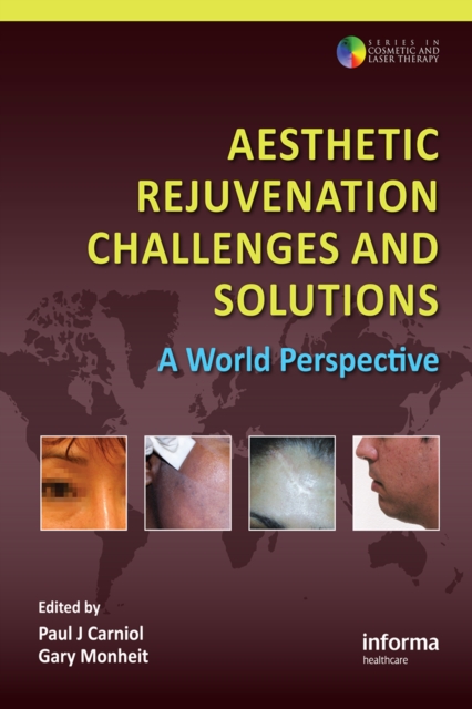 Aesthetic Rejuvenation Challenges and Solutions : A World Perspective, PDF eBook