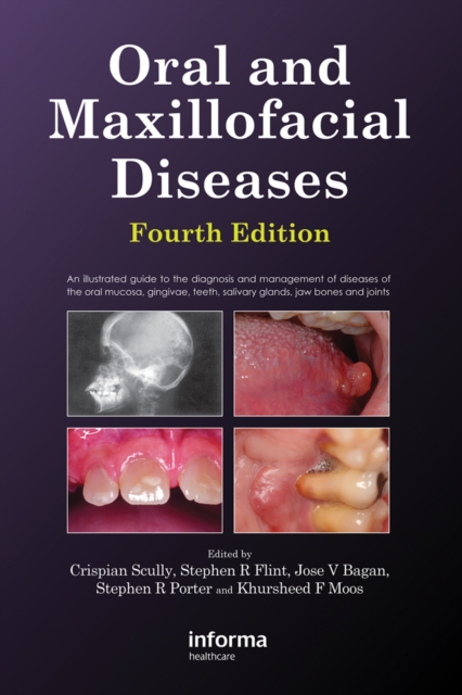 Oral and Maxillofacial Diseases, Fourth Edition, PDF eBook