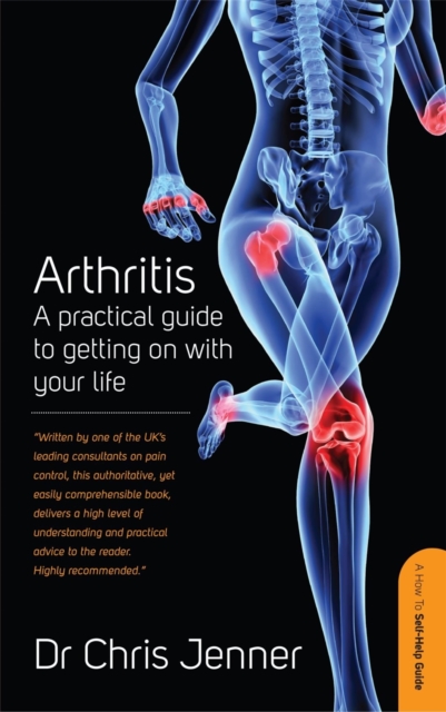 Arthritis : A Practical Guide to Getting on With Your Life, Paperback / softback Book
