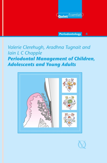 Periodontal Management of Children, Adolescents and Young Adults, EPUB eBook