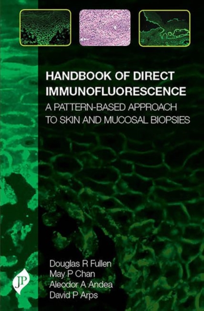 Handbook of Direct Immunofluorescence : A Pattern-Based Approach to Skin and Mucosal Biopsies, Hardback Book