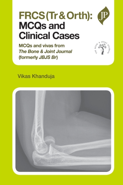 FRCS(Tr & Orth): MCQs and Clinical Cases, Paperback / softback Book