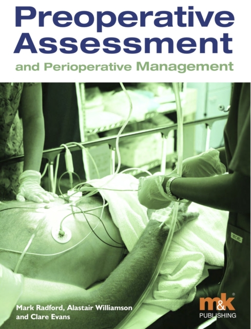 Preoperative Assessment and Perioperative Management, EPUB eBook