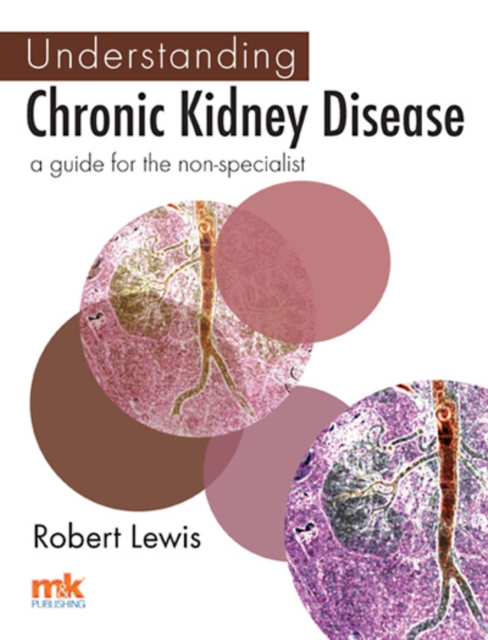 Understanding Chronic Kidney Disease : A  guide for the non-specialist, EPUB eBook
