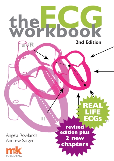 The ECG Workbook, EPUB eBook