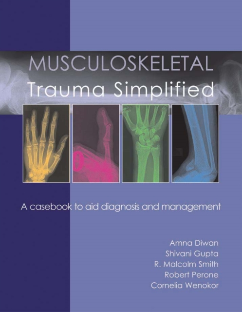 Musculoskeletal Trauma Simplified, PDF eBook