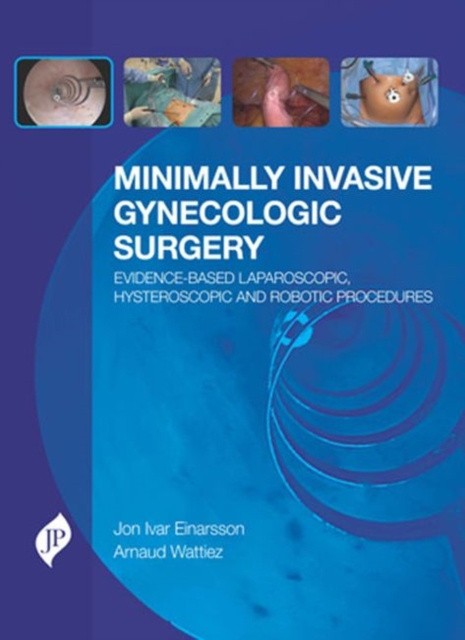 Minimally Invasive Gynecologic Surgery: Evidence-Based Laparoscopic, Hysteroscopic & Robotic Surgeries, Hardback Book