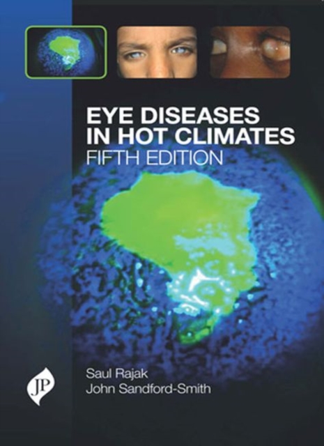 Eye Diseases in Hot Climates, Paperback / softback Book