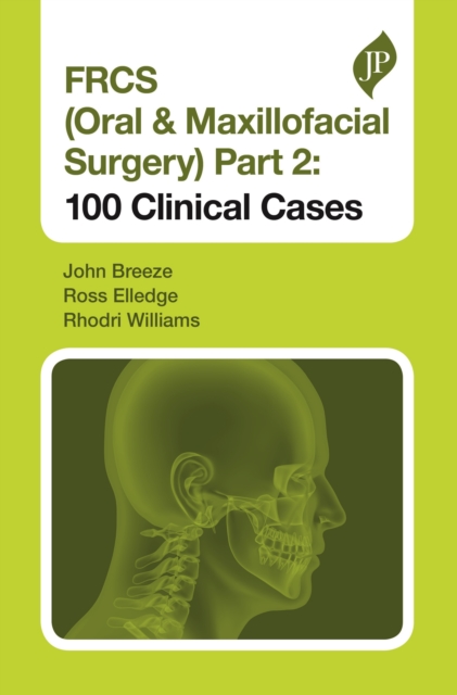 FRCS (Oral & Maxillofacial Surgery) Part 2: 100 Clinical Cases, Paperback / softback Book