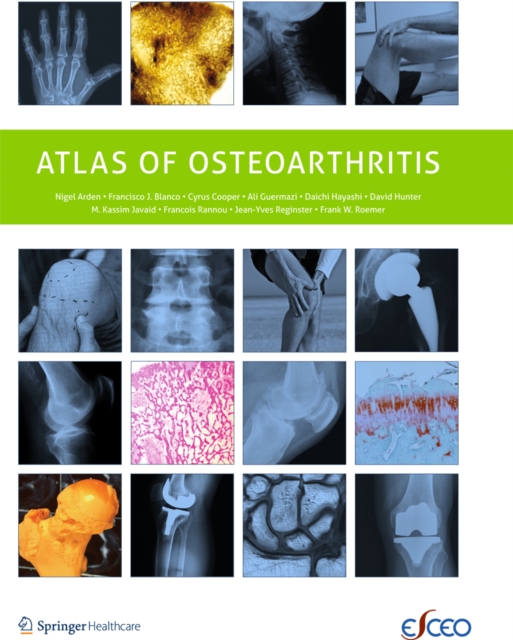 Atlas of Osteoarthritis, PDF eBook