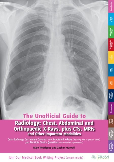 The Unofficial Guide to Radiology : Chest, Abdominal, Orthopaedic X Rays, plus CTs, MRIs and Other Important Modalities, EPUB eBook