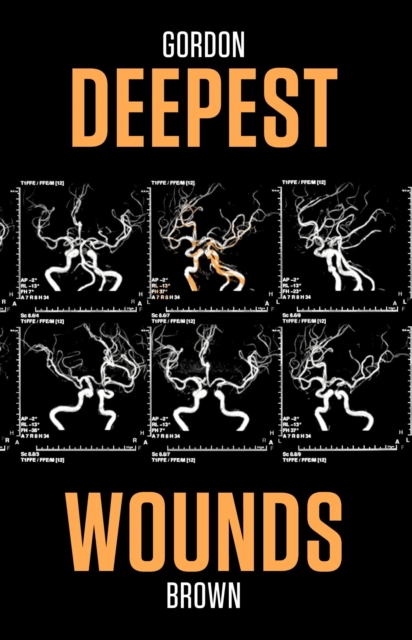 Deepest Wounds, EPUB eBook