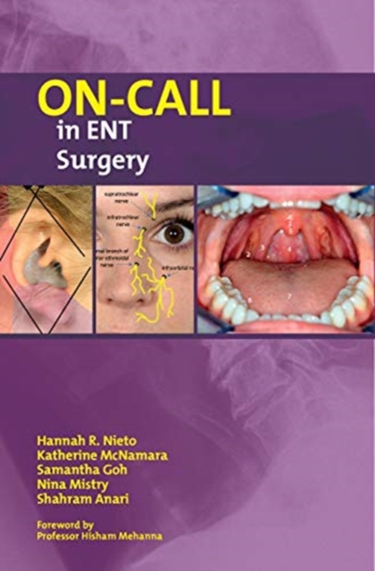 On-Call in ENT Surgery, Paperback / softback Book