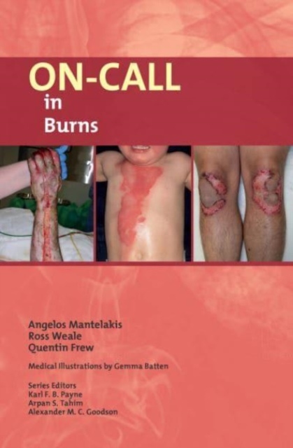 On-Call in Burns, Paperback / softback Book