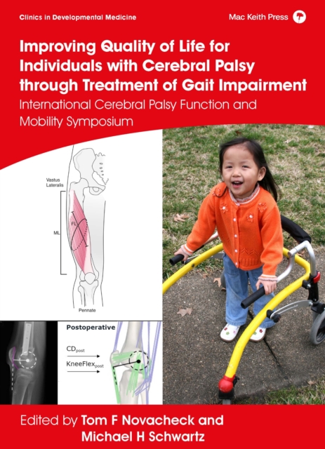 Improving Quality of Life for Individuals with Cerebral Palsy through treatment of Gait Impairment : International Cerebral Palsy Function and Mobility Symposium, PDF eBook
