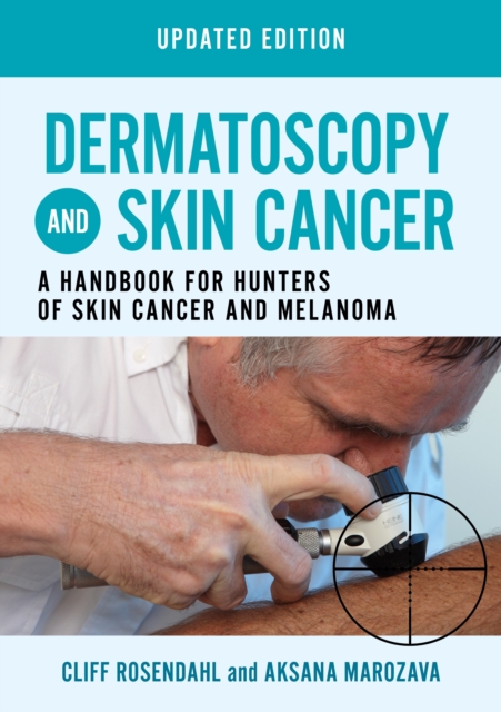 Dermatoscopy and Skin Cancer, updated edition : A handbook for hunters of skin cancer and melanoma, Paperback / softback Book