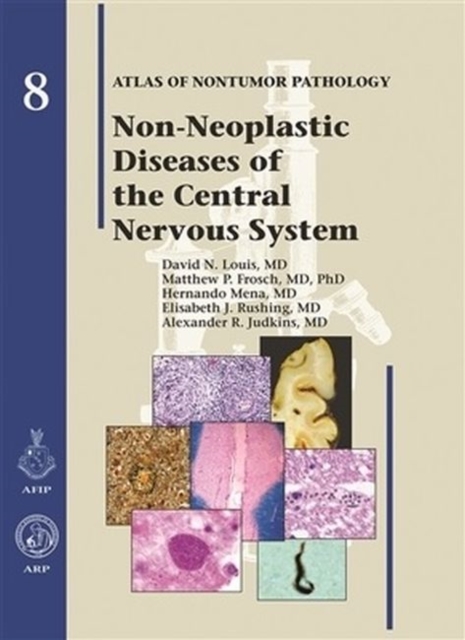 Non-Neoplastic Diseases of the Central Nervous System, Hardback Book